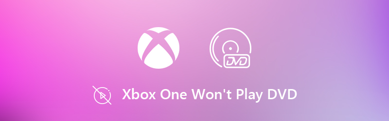 Xbox Oneでdvdを再生できない6つの方法 成功率が高い